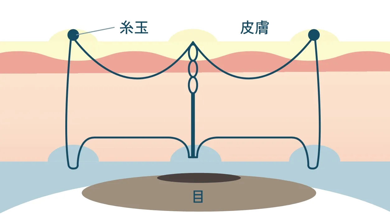 表留めクロス法の断面イメージ